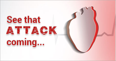 HAVING A HEART ATTACK – WHAT TO DO